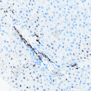 06 20240423_YM7213_sox-9 d200 R liver _20_IHC.png