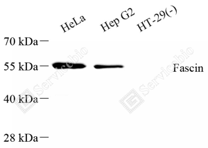 01 GB151025_Fascin_A102_ZSM22048240423_d1500_WB_WM.png