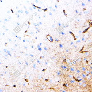 04 GB15529_Aquaporin 4_ZSM18040240407_d500_R brain_40.0x_IHC_WM.png