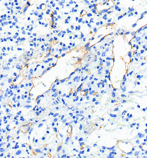 03 GB120005_CD31_1A8B1_1A8B120240424_d1000_M subcutaneous tumor of 4T1 cell_40.0x_IHC_WM.png