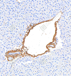 09 GB124197_Collagen I_2D2D6_2D2D620240322_d1000_M liver_20.0x_IHC_WM.png