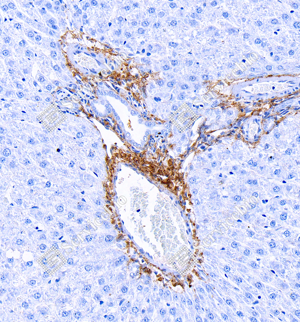 10 GB124197_Collagen I_2D2D6_2D2D620240322_d1000_R liver_30.0x_IHC_WM.png