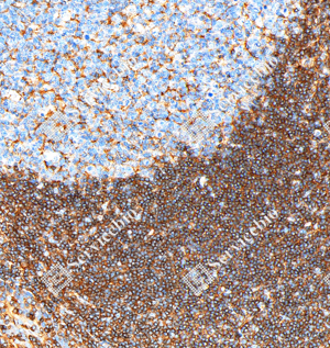 04 GB151264_Annexin-6 ANXA6_ZSM20007_ZSM20007240423_d1000_H tonsil_20.0x_IHC_WM.png