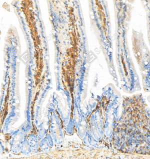 05 GB151264_Annexin-6 ANXA6_ZSM20007_ZSM20007240423_d1000_M Small intestine_20.0x_IHC_WM.png