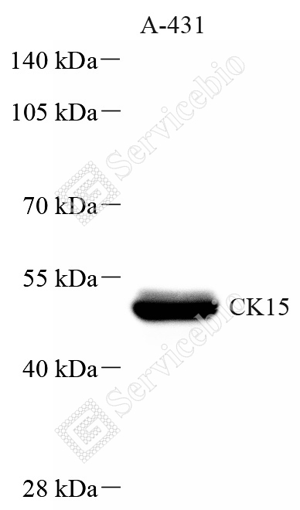 01 GB151648_Cytokeratin 15_A67_ZCM21016240402_d1500_WB_WM.png