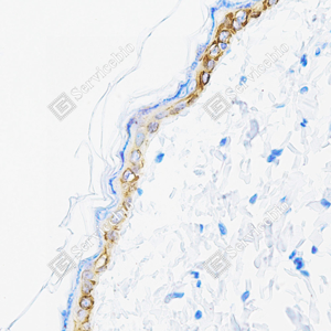 03 GB151648_Cytokeratin 15_ZCM21016_ZCM21016240402_d500_R skin_40.0x_IHC_WM.png