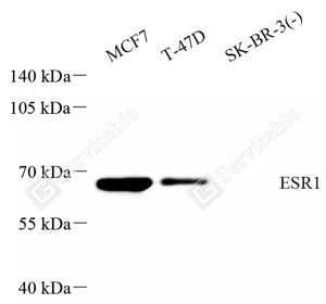 01 GB151845_Estrogen Receptor alpha_A103_ZSM22058240423_d1000_WB_WM.png