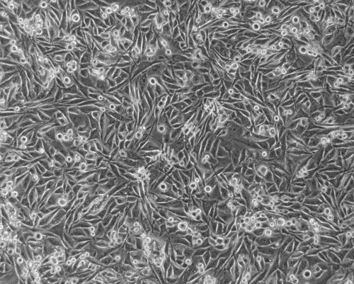 Calu-6-LUC-GFP-白光.jpg