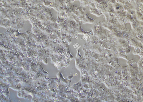 HCC827-LUC-GFP-白光.jpg