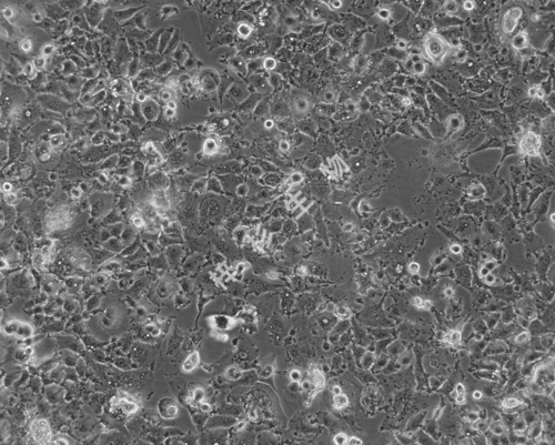 HCCLM3-LUC-GFP-白光.jpg