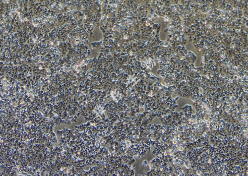 HEC-1-A-LUC-GFP-白光.jpg