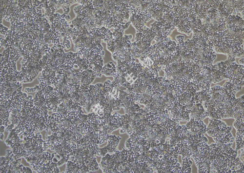 HepG2-LUC-GFP-白光.jpg