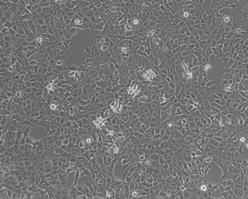 HuH-7-LUC-GFP-白光.jpg