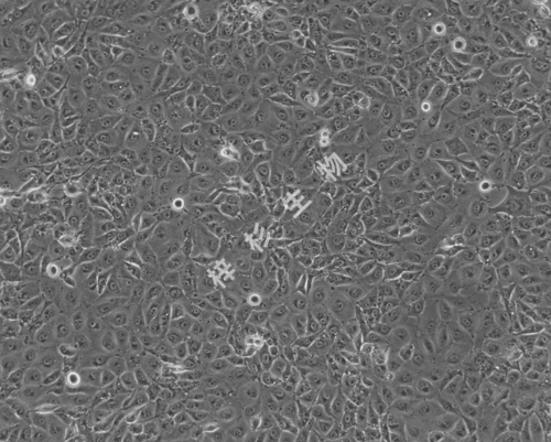 Mahlavu-LUC-GFP-白光.jpg