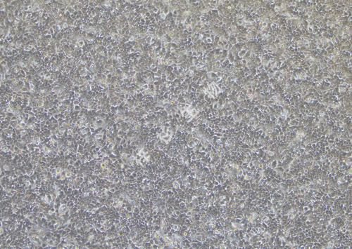 MHCC97-L-LUC-GFP-白光.jpg
