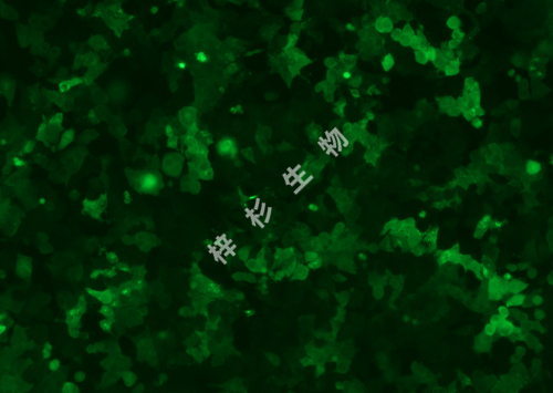 MHCC97-L-LUC-GFP-荧光.jpg