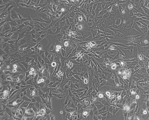 NCI-H226-LUC-GFP-白光.jpg
