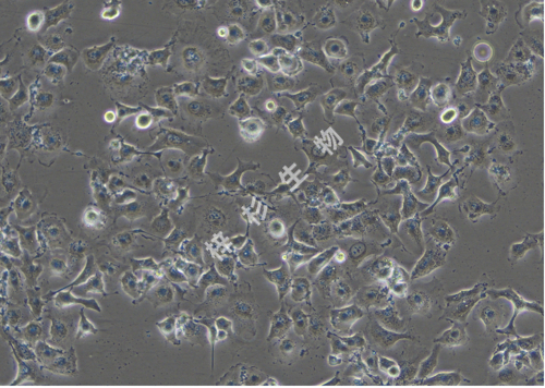 NCI-H661-LUC-GFP-白光.jpg