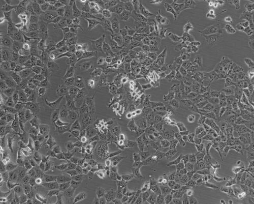 NCI-H1299-LUC-GFP-白光.jpg