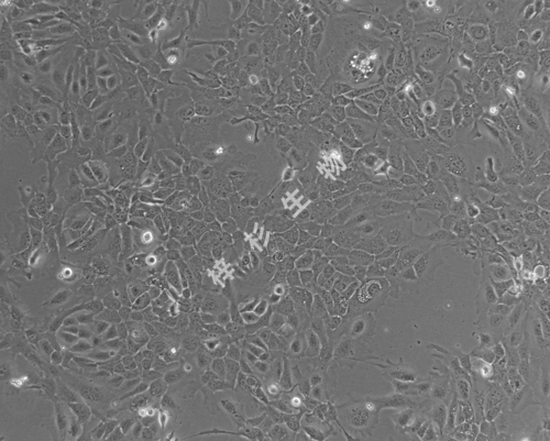 NCI-H1568-LUC-GFP-白光.jpg