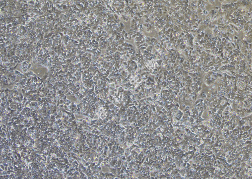 NCI-H1944-LUC-GFP-白光.jpg