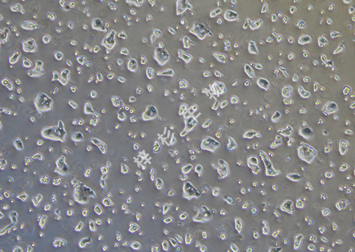 NCI-N87-LUC-GFP-白光.jpg