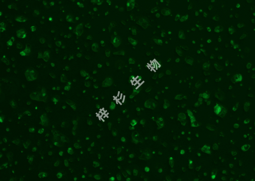 NCI-N87-LUC-GFP-荧光.jpg