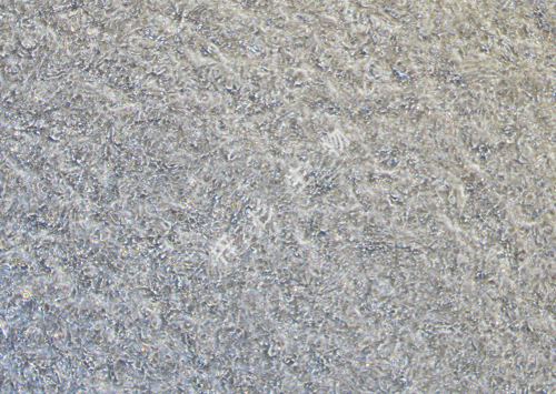 SK-MES-1-LUC-GFP-白光.jpg