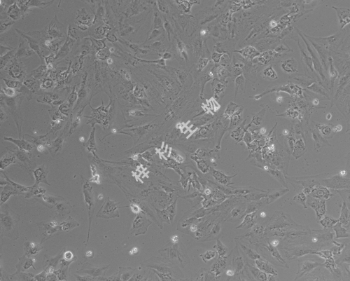 SNU-387-LUC-GFP-白光.jpg