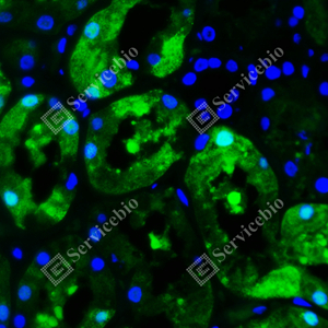 06 GB115541_FGFR1_green_d100_H kidney_40x_IF.jpg