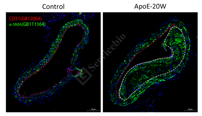 胸主CS7-对照-3 IF CD31红+q-SMA绿_12.0x-2.jpg