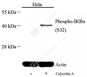 01 GB15212_Phospho-IKB alpha（S32）_A121_d500_WB.png