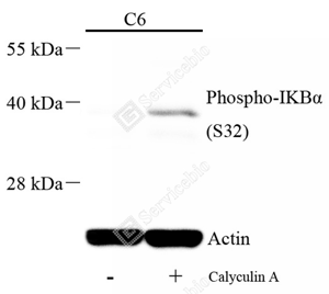 03 GB15212_Phospho-IKB alpha（S32）_A121_d500_WB.png