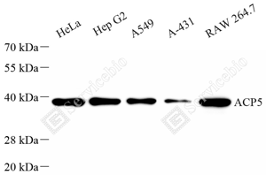 01 GB15416_Tartrate Resistant Acid Phosphatase_A58_d1000_WB_WM.png