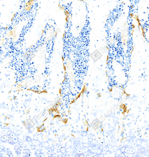 02 GB15416_Tartrate Resistant Acid Phosphatase_ZCM20054_ZCM20054240402_d1000_M bone_20.0x_IHC_WM.png