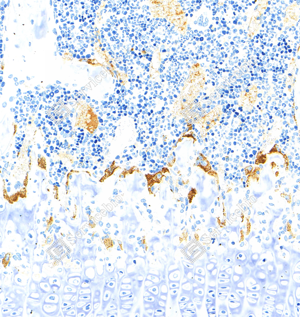 03 GB15416_Tartrate Resistant Acid Phosphatase_ZCM20054_ZCM20054240402_d1000_M bone_20.0x_IHC_WM.png