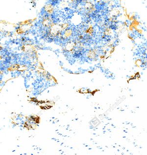 04 GB15416_Tartrate Resistant Acid Phosphatase_ZCM20054_ZCM20054240402_d1000_R bone_20.0x_IHC_WM.png