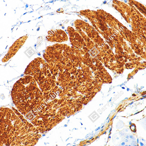 05 GB15960_Caldesmon CDM_ZSM22178_ZSM22178240423_d3000_M stomach_33.0x_IHC_WM.png