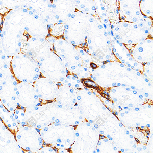 08 GB15960_Caldesmon CDM_ZSM22178_ZSM22178240423_d3000_R kidney_23.0x_IHC_WM.png