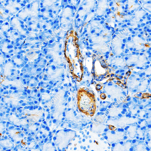 09 GB15960_Caldesmon CDM_ZSM22178_ZSM22178240423_d3000_R pancreas_23.0x_IHC_WM.png