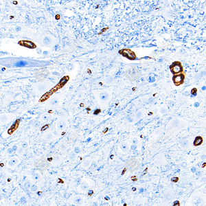 10 GB15960_Caldesmon CDM_ZSM22178_ZSM22178240423_d3000_R spinal marrow_33.0x_IHC_WM.png