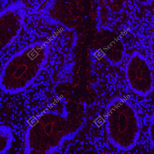 03 GB151981_ZO1 tight junction protein-red_A139_A13920240524_d800_H colon_40.0x_IF.png