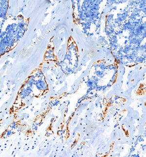 03 GB115706_Osteoprotegerin_C2620_C262022080902_d1000_M bone_20.0x_IHC.png