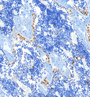 04 GB115706_Osteoprotegerin_C2620_C262022080902_d1000_R bone_20.0x_IHC.png