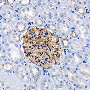 02 GB115686_ZO1 tight junction protein_C3502_C350223091903_d1000_M kidney_40.0x_IHC_WM.jpg