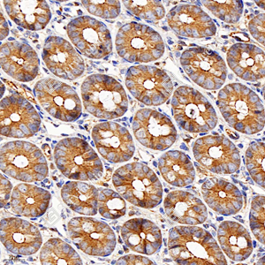 04 GB115686_ZO1 tight junction protein_C3502_C350223091903_d1000_R duodenum_40.0x_IHC_WM.jpg