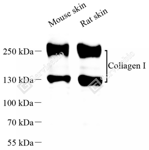 01 GB115707_Collagen I_C1757-02_d1000_WB_WM.png