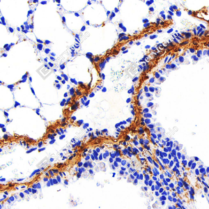 02 GB115707_Collagen I_C1758_C175822012502_d1000_M lung_40.0x_IHC_WM.png