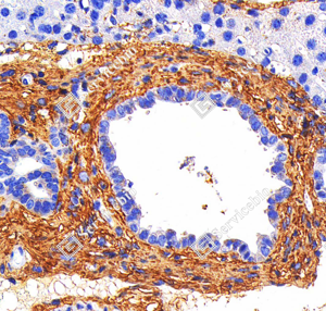 06 GB115707_Collagen I_C1758_C175822012502_d1000_M fibrotic liver_40.0x_IHC_WM.png