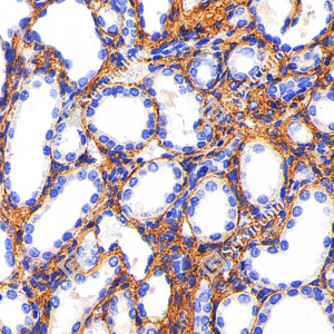 08 GB115707_Collagen I_C1758_C175822012502_d1000_R fibrotic kidney_40.0x_IHC_WM.png